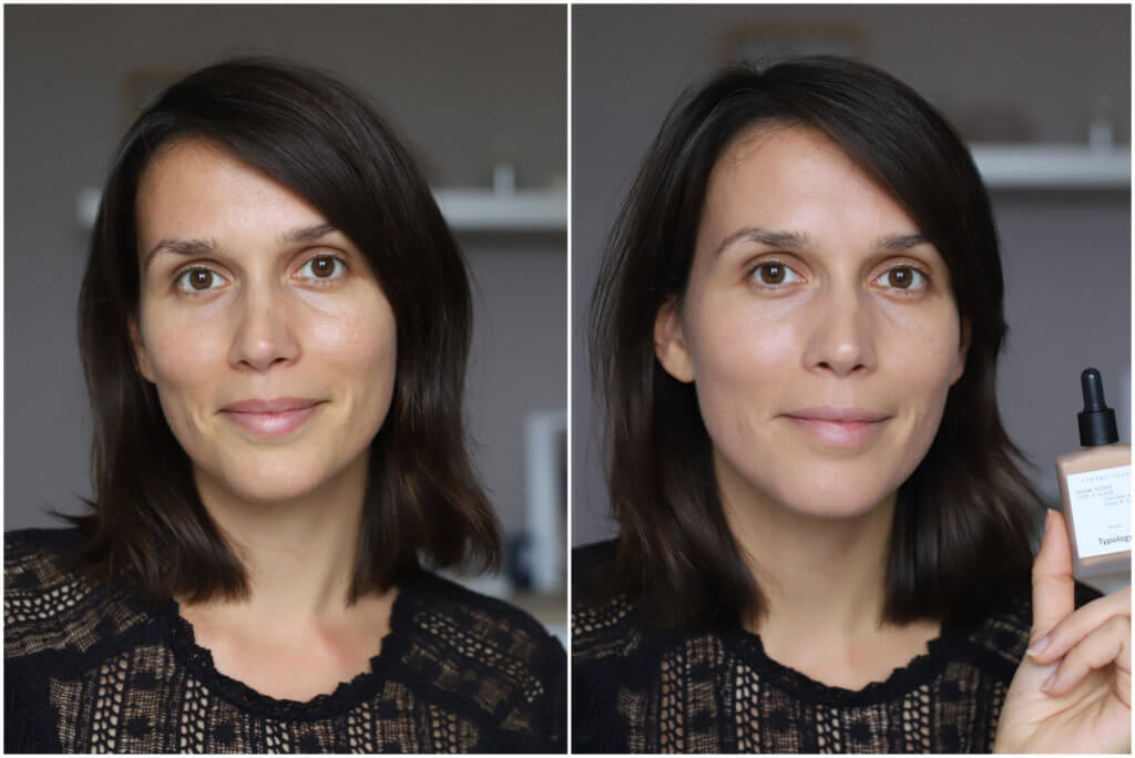 avant-apres-serum-teinté-typology